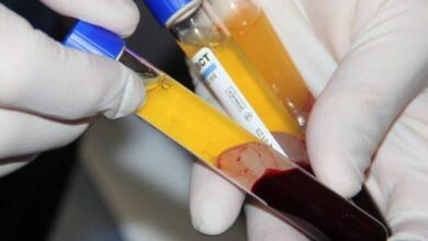 صورة في إطار المشروع القومي لمشتقات البلازما.. تعرف على أهمية بلازما الدم